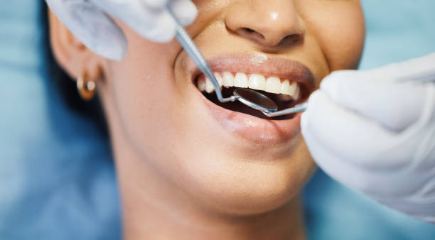 Best Urgent Tooth Repair  in Wildwood, FL