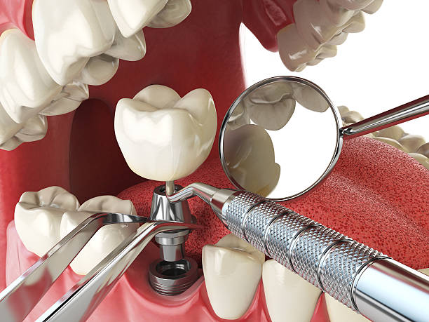 Best Cracked Tooth Emergency Dentist  in Wildwood, FL